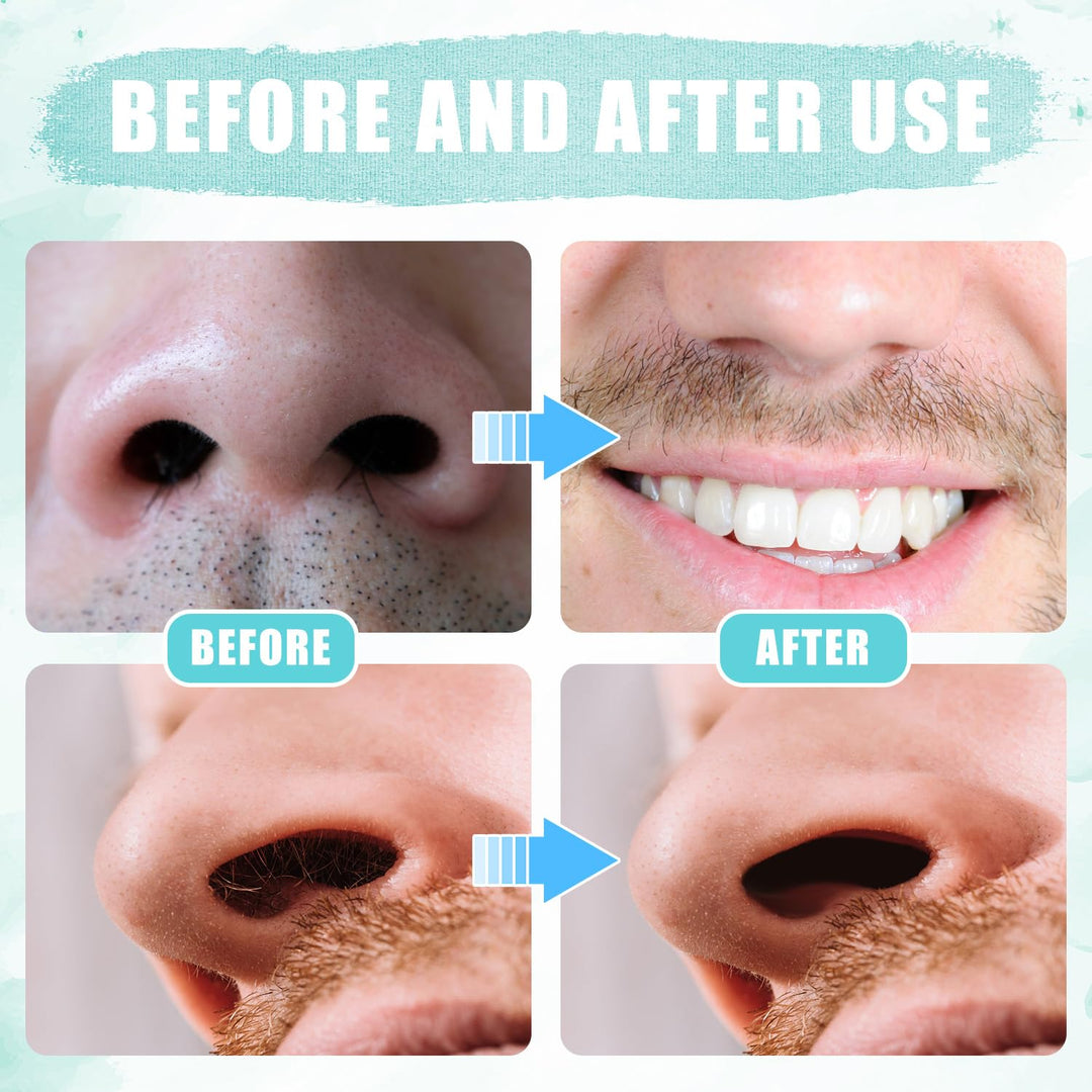 12pcs 2 in 1 Nasal Hair Cutter, 360 Rotating Nose Hair Trimmer for Men Women Double Sided Nose Hair Cleaner with Ear Picker Portable Manual Nostril Hair Removal Tool (Blue)